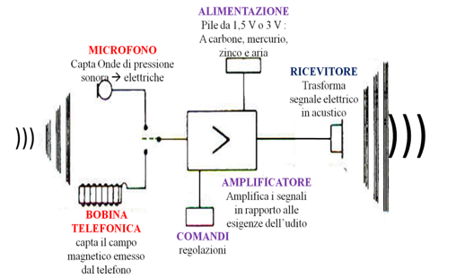 Come funziona un apparecchio acustico - Audiomedical